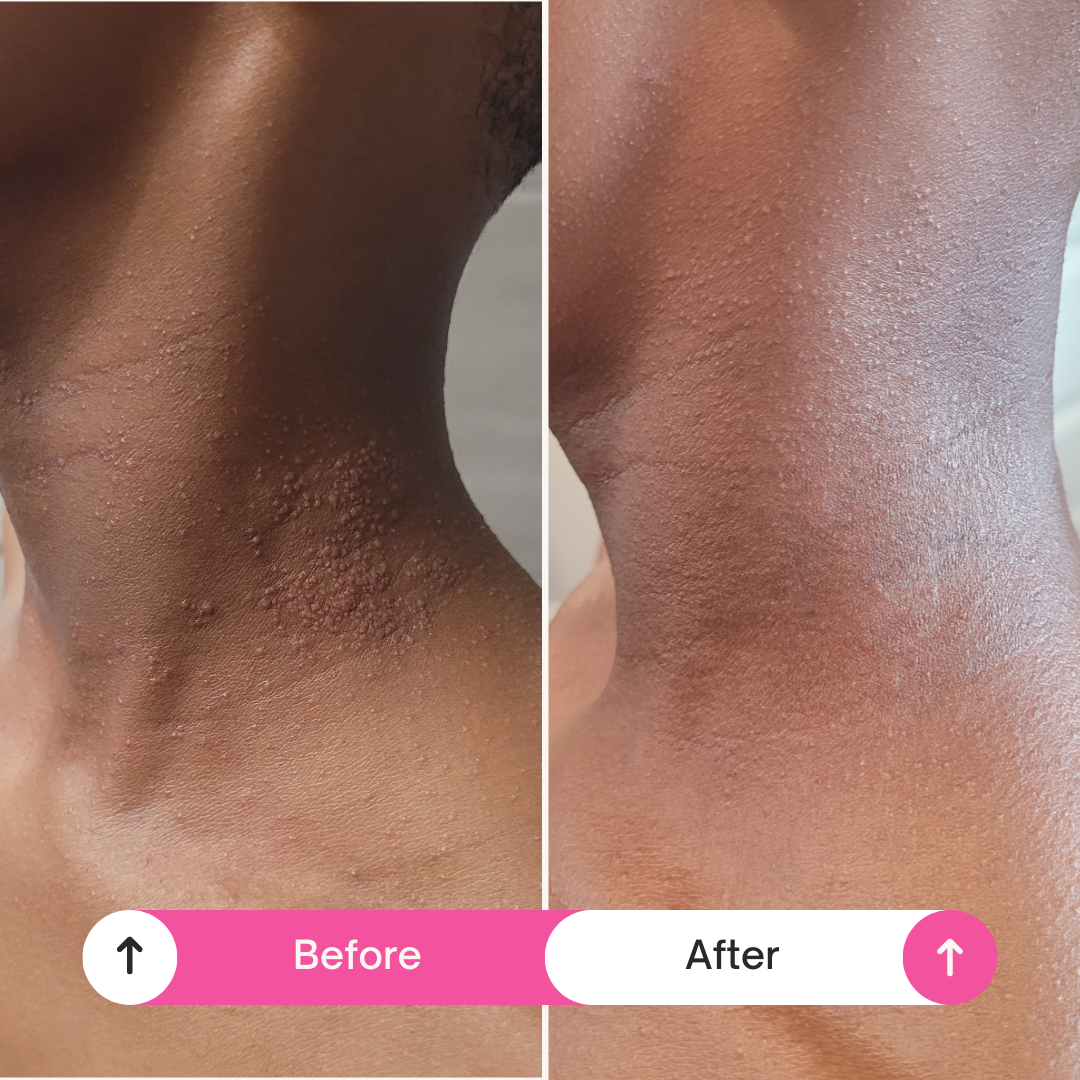 A by A’amia Skinfolk care moment