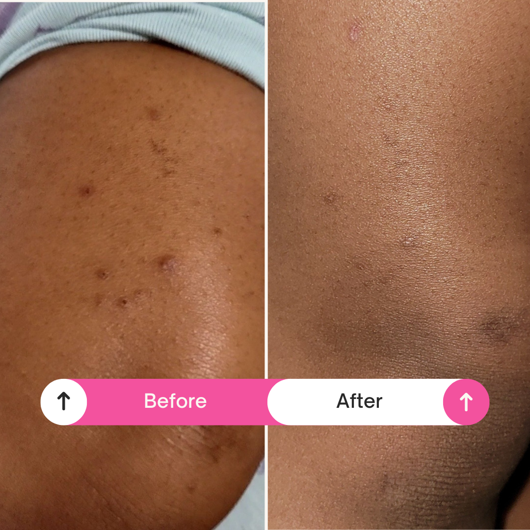 A by A’amia Skinfolk care moment