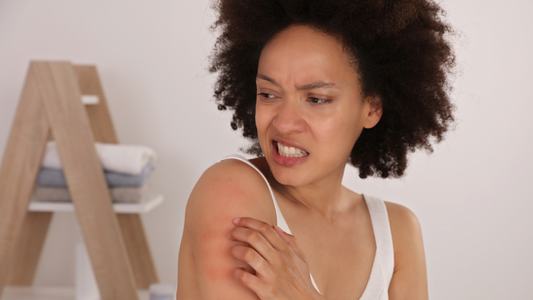 The Ultimate Guide to Identifying Eczema Triggers for Clearer Skin