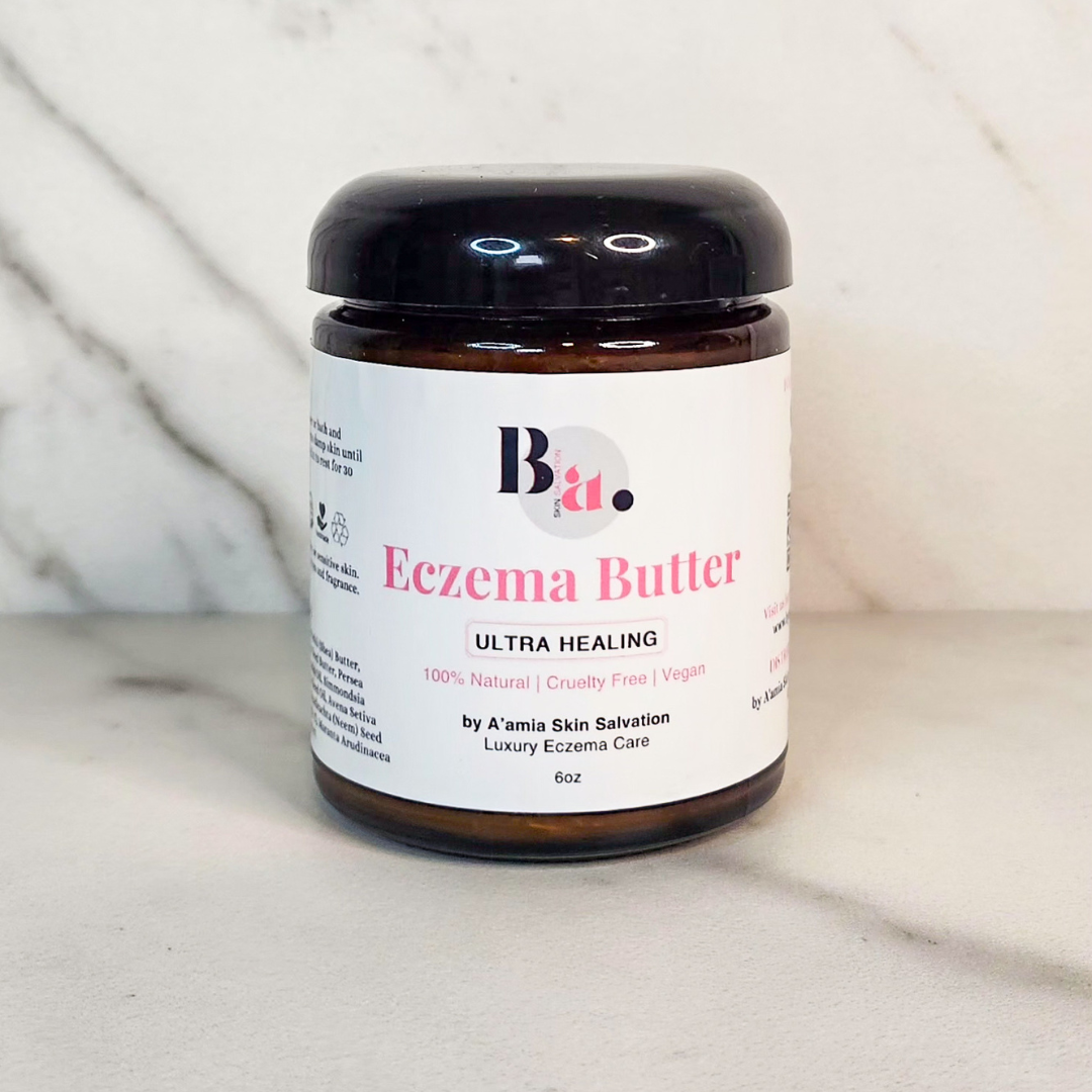 Body butter for eczema and dry skin