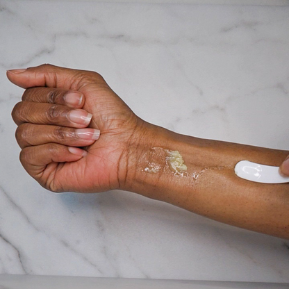 by A'amia Eczema Salve being applied in a small amount to the inside of an arm.